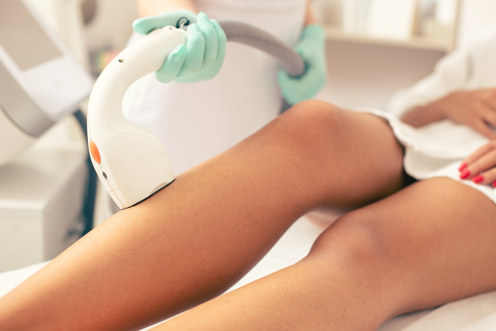 Gloved clinician's hand holding a laser hair removal handpiece against a patient's bare leg during a treatment session