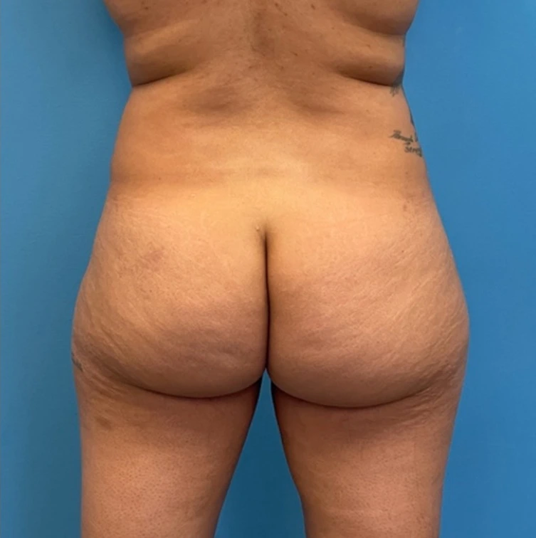 Case--25704 | Before Body 2