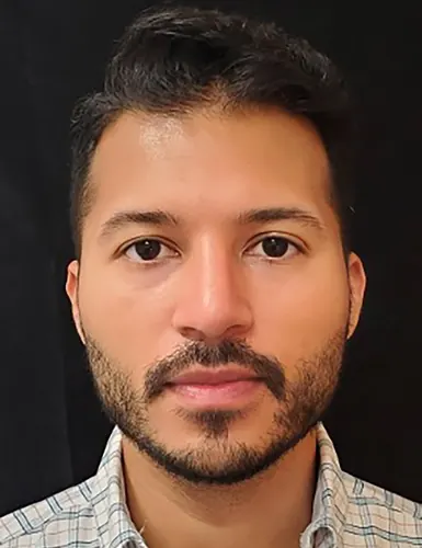 Male Rhinoplasty Case #379 — after, Dr. Arjun Kanuri