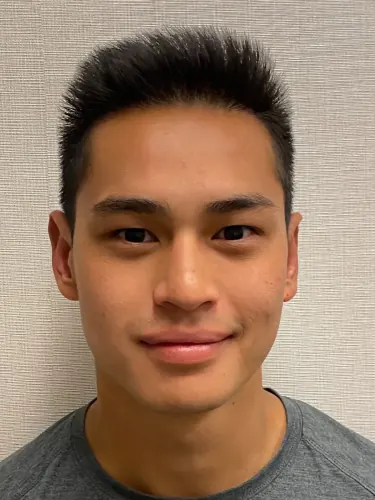 Otoplasty Case #2681 — after, Dr. Arjun Kanuri