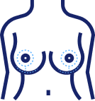 Lollipop incision pattern for breast lift and reduction
