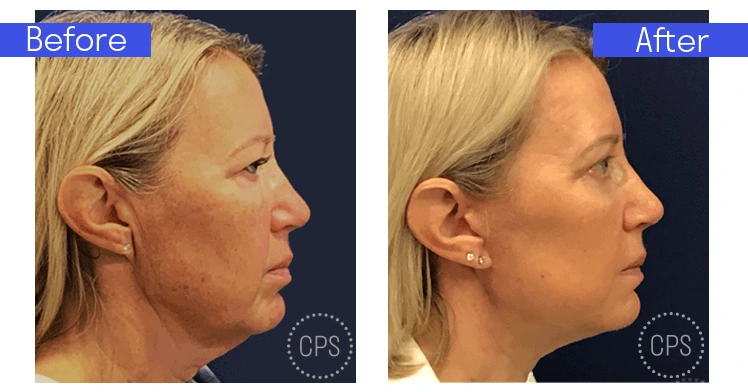 Bitar Institute FACE360 – A Comprehensive Evaluation