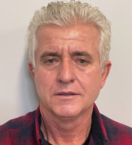 Facelift-Blepharoplasty-Case--291 | Before Facelift for Men 1