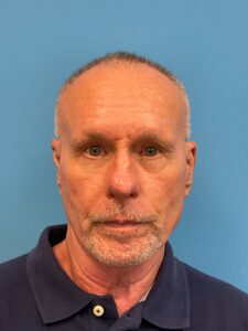 Rhinoplasty-Case--3129 | Before Rhinoplasty for Men 1