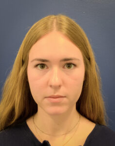 Rhinoplasty-Case--6484 | Before Dr. Arjun Kanuri 1