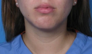 Case--293 | After Dr. Samir Rao 1