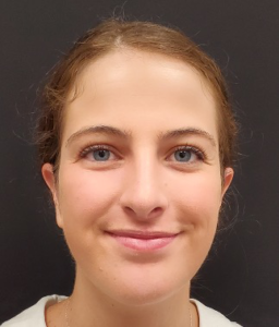 Rhinoplasty-and-Chin-Implant-Case--381 | After Dr. Arjun Kanuri 1