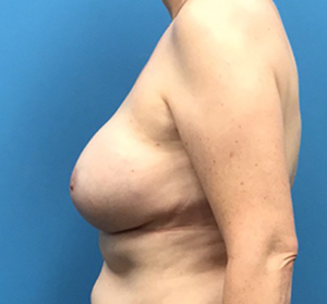 Case--135 | After Dr. Samir Rao 2