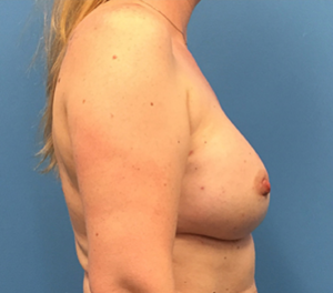 Case--138 | After Dr. Samir Rao 2