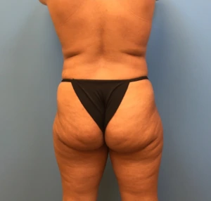 Case--247 | Before Body 2