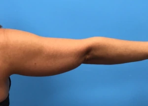 Case--280 | Before Body 2