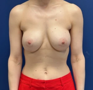 Revision-Augmentation-Case--26939 | Before Revision Augmentation 1