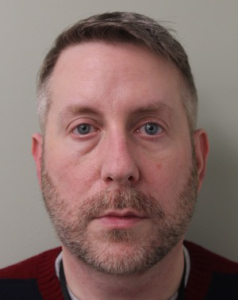 Lower-Blepharoplasty-Case--359 | Before Eyelid Surgery 1