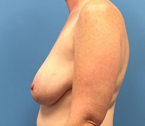 Case--137 | Before Dr. Samir Rao 2