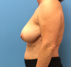 Case--314 | Before Dr. Samir Rao 2