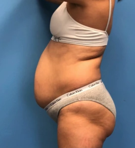 Case--14819 | Before Body 2