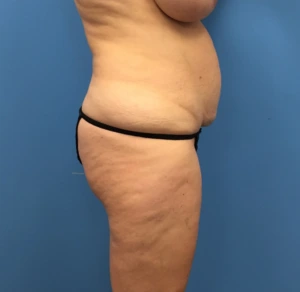 Case--248 | Before Body 2